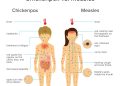 Measles Outbreak…  OVER 1,311,860 CHILDREN TO BE VACCINATED NATIONWIDE