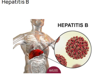 13.8% People Live with Hepatitis-B in Sierra Leone  – Dr. Sulaiman Lakkoh