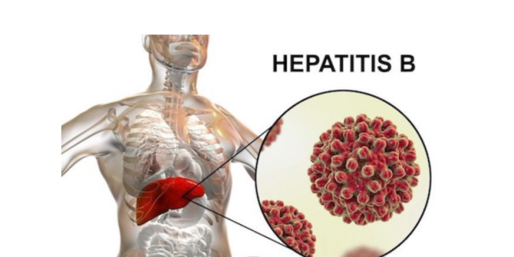 13.8% People Live with Hepatitis-B in Sierra Leone  – Dr. Sulaiman Lakkoh