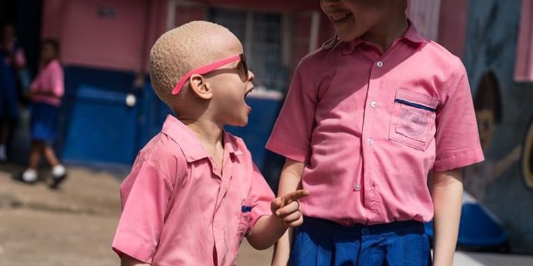 Ending Witchcraft Accusations…  Global Call to Protect People with Albinism