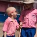 Ending Witchcraft Accusations…  Global Call to Protect People with Albinism
