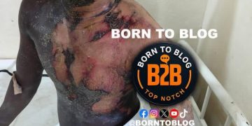 Man Set Ablaze Over Theft Allegation in Kenema